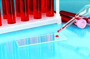 Hematosology of blood drops for pests