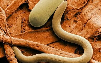 The causes of worms to people
