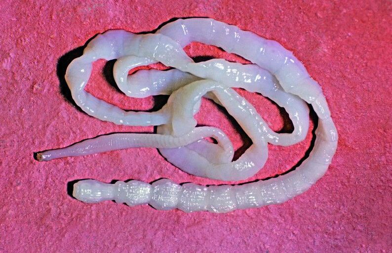 Cattle tapeworm is a common intestinal helminth.