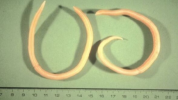 Roundworms are worms that manifest as fatigue and a cough.