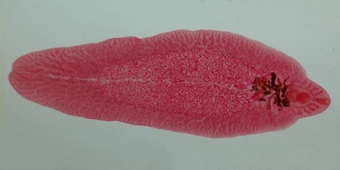 fluke worm in humans